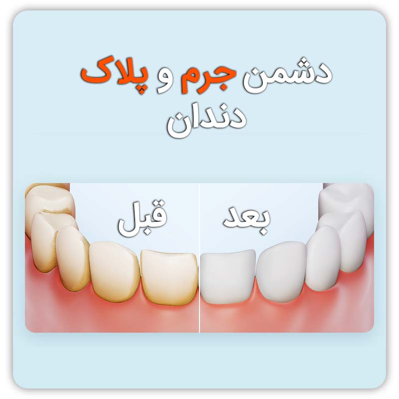 دستگاه شستشوی دهنده دهان و دندان شیائومی مدل F300