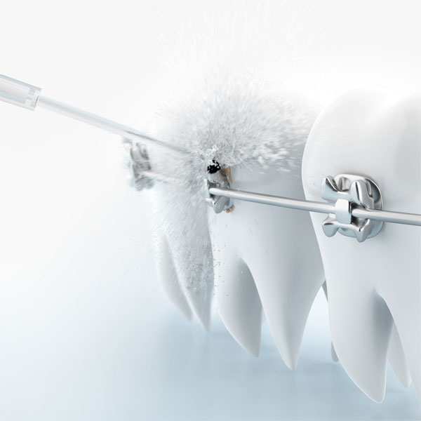 دستگاه شستشوی دهنده دهان و دندان شیائومی مدل Dr.Bei F3